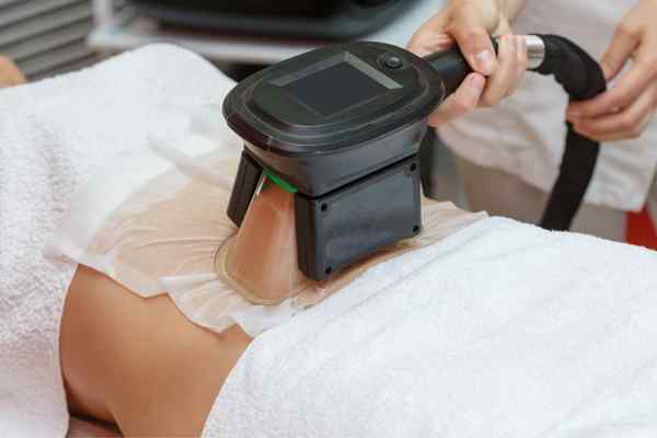 Areas of the Body we treat Cryolipolysis Bracknell 	