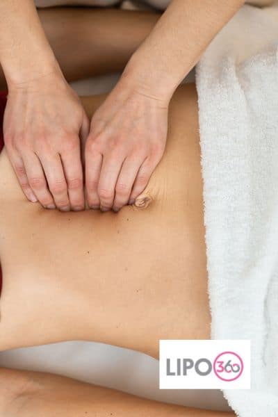 diastasis recti treatment Bracknell 	