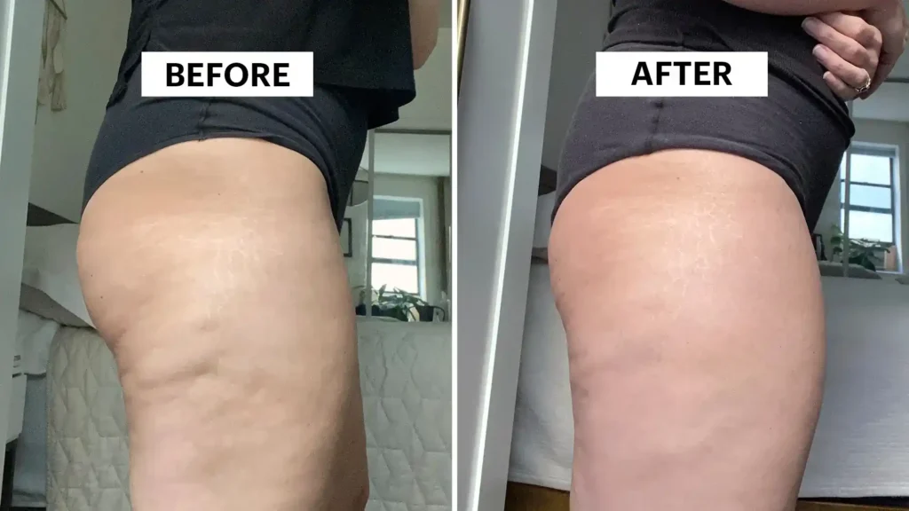 Do Toning Exercise Bracknell 	 Really Tackle Cellulite?